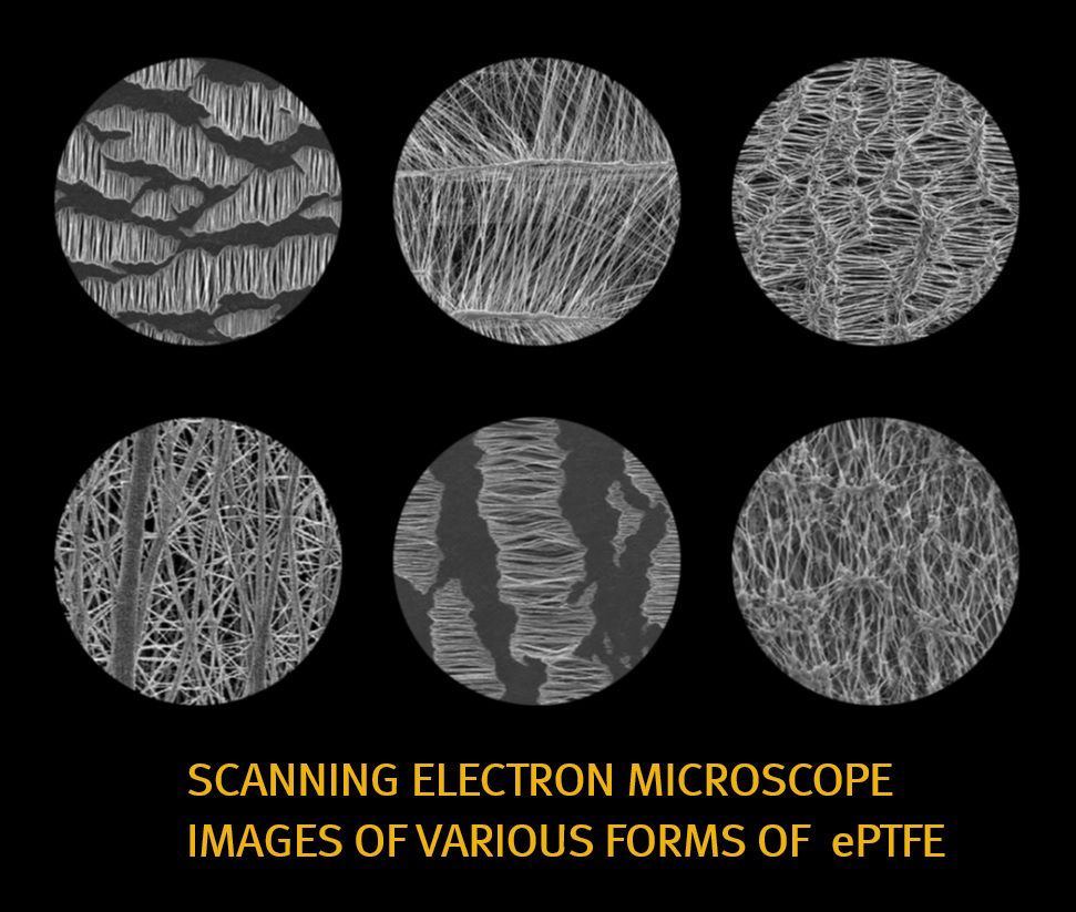 各种形式膨体聚四氟乙烯(ePTFE)的扫描电子显微镜图像